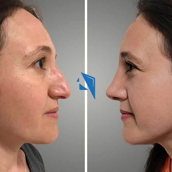 Op. Dr. Hasan Karataş 